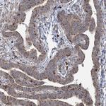 TRAF3IP2 Antibody in Immunohistochemistry (Paraffin) (IHC (P))