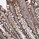 TRAF3IP2 Antibody in Immunohistochemistry (Paraffin) (IHC (P))