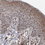 TRAF3IP2 Antibody in Immunohistochemistry (Paraffin) (IHC (P))