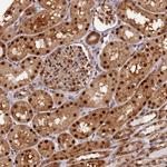 NPEPL1 Antibody in Immunohistochemistry (Paraffin) (IHC (P))