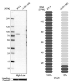 GCLC Antibody in Western Blot (WB)