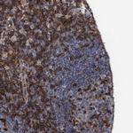 SLP76 Antibody in Immunohistochemistry (Paraffin) (IHC (P))