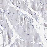 SLP76 Polyclonal Antibody