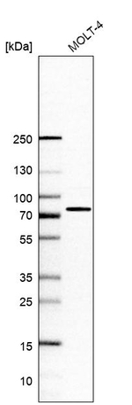 SLP76 Antibody in Western Blot (WB)