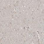 EHHADH Polyclonal Antibody