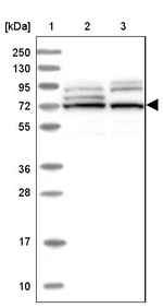 EHHADH Antibody in Western Blot (WB)