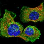 Clathrin Light Chain B Polyclonal Antibody