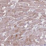 HOMER1 Antibody in Immunohistochemistry (Paraffin) (IHC (P))