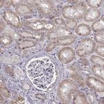 SLC4A5 Polyclonal Antibody