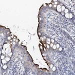 NHE3 Antibody in Immunohistochemistry (Paraffin) (IHC (P))