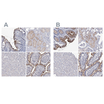 NHE3 Polyclonal Antibody