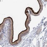 NHE3 Antibody in Immunohistochemistry (Paraffin) (IHC (P))