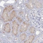 NHE3 Antibody in Immunohistochemistry (Paraffin) (IHC (P))
