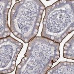 NHE3 Antibody in Immunohistochemistry (Paraffin) (IHC (P))