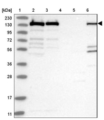 PLCG1 Antibody in Western Blot (WB)