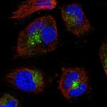 VAMP7 Antibody in Immunocytochemistry (ICC/IF)