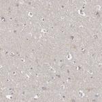 P2Y10 Antibody in Immunohistochemistry (Paraffin) (IHC (P))