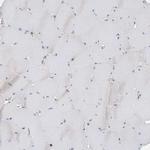 P2Y10 Antibody in Immunohistochemistry (Paraffin) (IHC (P))