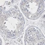 P2Y10 Antibody in Immunohistochemistry (Paraffin) (IHC (P))