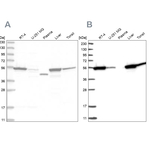CNDP2 Antibody in Western Blot (WB)