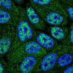 CNDP2 Polyclonal Antibody