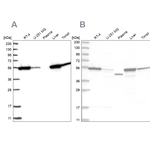 CNDP2 Antibody in Western Blot (WB)