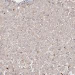 KIF20A Antibody in Immunohistochemistry (Paraffin) (IHC (P))