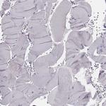 PDE8B Polyclonal Antibody