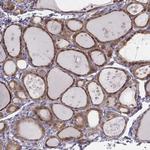 PDE8B Antibody in Immunohistochemistry (Paraffin) (IHC (P))