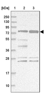 STIM2 Antibody in Western Blot (WB)