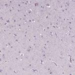 NOLC1 Antibody in Immunohistochemistry (Paraffin) (IHC (P))