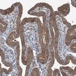 SNX2 Antibody in Immunohistochemistry (Paraffin) (IHC (P))