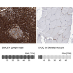 SNX2 Antibody in Immunohistochemistry (Paraffin) (IHC (P))