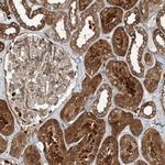 SNX2 Antibody in Immunohistochemistry (Paraffin) (IHC (P))