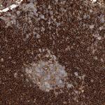 SNX2 Antibody in Immunohistochemistry (Paraffin) (IHC (P))