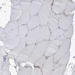 SNX2 Antibody in Immunohistochemistry (Paraffin) (IHC (P))