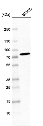 SNX2 Antibody in Western Blot (WB)