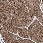 SMC3 Antibody in Immunohistochemistry (Paraffin) (IHC (P))