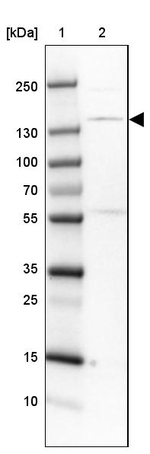 SMC3 Antibody in Western Blot (WB)