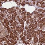 TARS Antibody in Immunohistochemistry (Paraffin) (IHC (P))