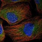 NCE2 Antibody in Immunocytochemistry (ICC/IF)