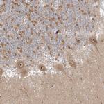 NCE2 Antibody in Immunohistochemistry (Paraffin) (IHC (P))