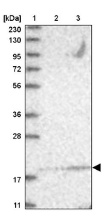 NCE2 Antibody in Western Blot (WB)