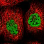 ZCCHC8 Polyclonal Antibody