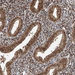 ZCCHC8 Antibody in Immunohistochemistry (Paraffin) (IHC (P))