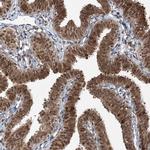 ZCCHC8 Antibody in Immunohistochemistry (Paraffin) (IHC (P))