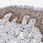 ZCCHC8 Antibody in Immunohistochemistry (Paraffin) (IHC (P))