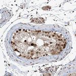 ZCCHC8 Antibody in Immunohistochemistry (Paraffin) (IHC (P))