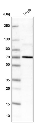ZCCHC8 Antibody in Western Blot (WB)