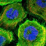 AADAT Polyclonal Antibody